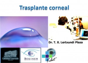 Actualización en Queratocono Trasplante corneal
